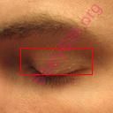 eyelid (Oops! image not found)